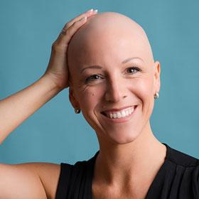 Alopecia