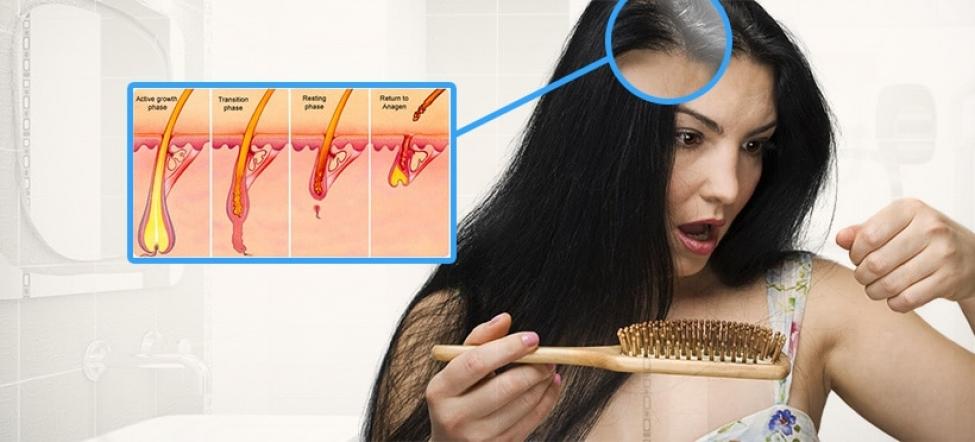 Female Baldness: Why Do Some Women Lose Their Hair? Female Baldness: Why Do Some Women Lose Their Hair?