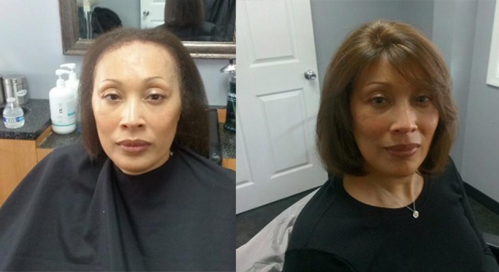 Transitions Hair Solutions Specialize In 3D Hair & Scalp Restoration Transitions Hair Solutions Specialize In 3D Hair & Scalp Restoration