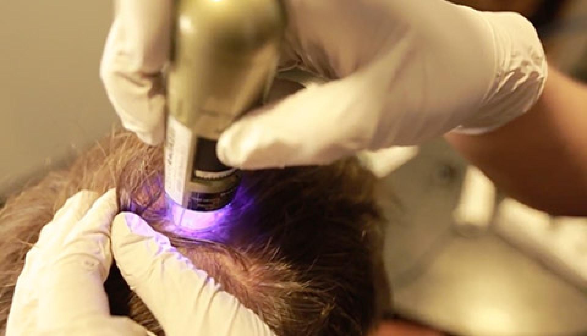 CRLAB Trichological Treatments