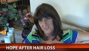 Hair System Helps Woman Recover After Cancer Treatment